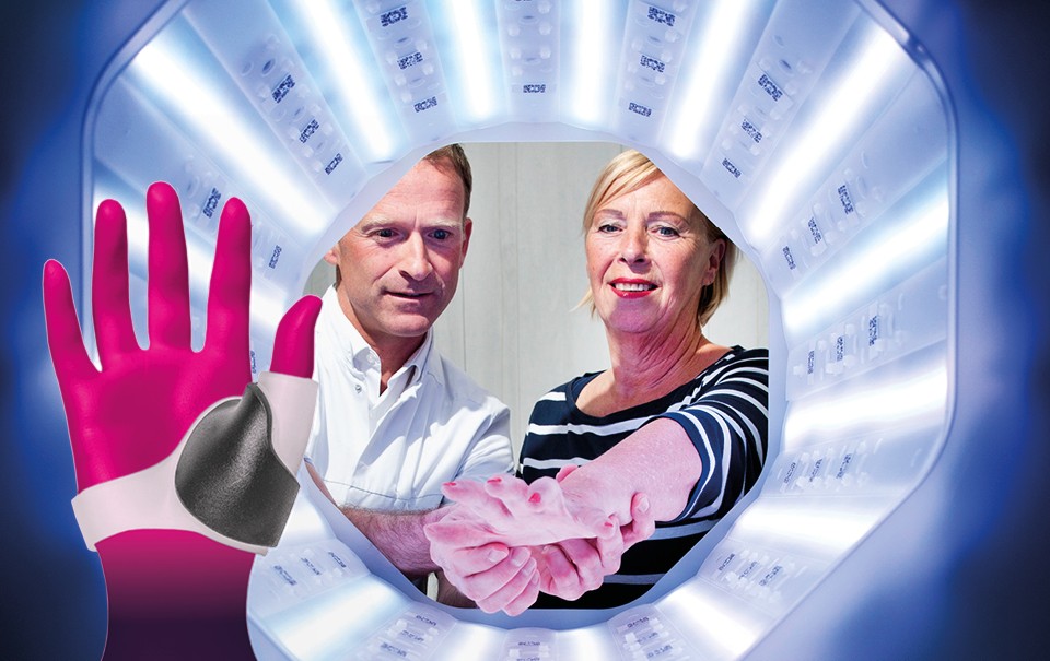 Studie von Daumenschienen im 3D-Silikondruck